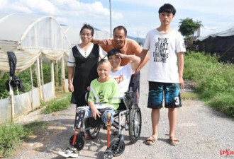 火中救弟烧伤9成下肢被截 女孩588分上大学
