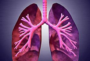 肺纤维化病人连续增长，应该如何预防？