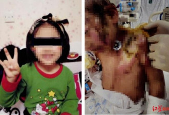 钳子拔牙、热水烫后冲凉水…6岁女童被虐案宣判