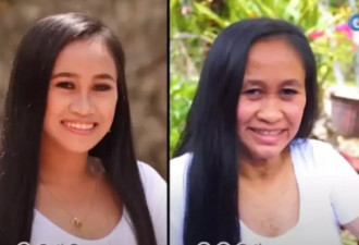菲律宾16岁少女2年间极速老化 像50岁