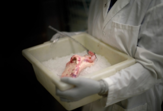 猪肾脏移植给人类 为何猪是理想器官来源？