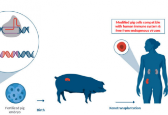 猪肾脏移植给人类 为何猪是理想器官来源？