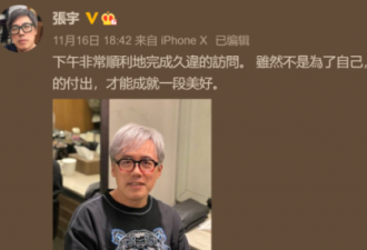 54岁歌手张宇曝近况 已停工4年 如今满头白发