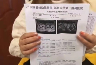 郑州八胞胎孕妇年仅18岁 丈夫：自由恋爱