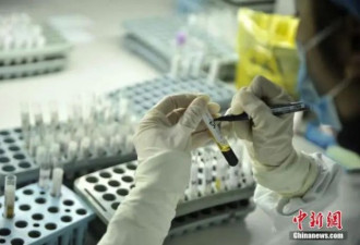 中国艾滋病感染数超105万 50岁以上占比上升