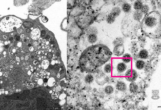 Omicron病毒真实面貌曝 显微镜下刺突蛋白可见