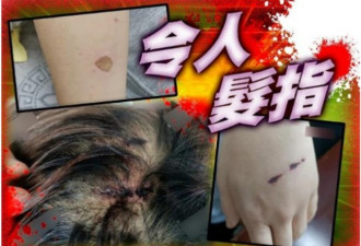 陕西13岁少女遭殴打迫卖淫 嫖客良心发现送回家