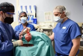 美国首例猪心器官已移植人体状况良好