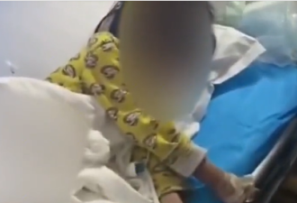 4岁女孩疑遭后妈虐待双脚烧伤险截肢