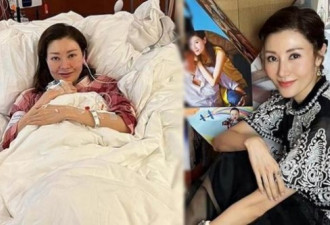 港姐李嘉欣险成植物人 医生直言捡回一命
