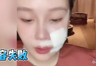 赵本山女儿整容失败，自曝如今整张脸毁了