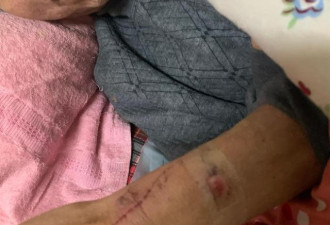 上海一老人在养老院疑遭护理员捆绑 四肢有伤