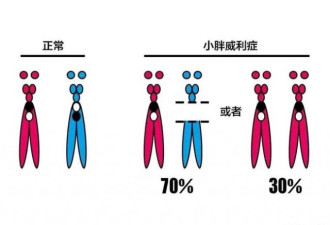 18次产检结果都正常，可新生儿身患众多疾病？