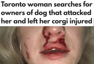 多伦多女子遛狗被大狗咬伤，满脸是血！