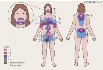 114万年前人类褪毛发 7万年前穿衣服为何