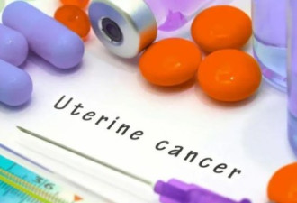 不做健康落后分子 妇科癌症防控策略