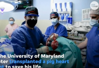 世界首例猪心移植成功患者 术后2个月去世