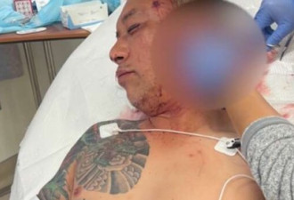 凶残 华人男子在洛杉矶无故被捅10刀