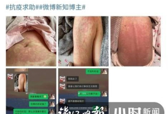 白血病女孩称上海医院拒收：已现血斑
