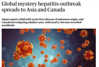 加拿大儿童中出现&quot;来源不明&quot;的严重肝炎病例