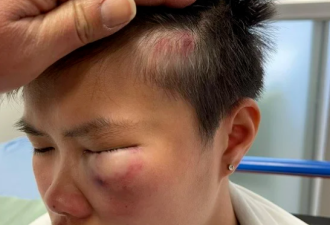 加拿大高中现种族歧视，14岁少女被打昏