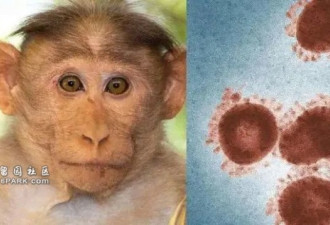 欧美突然暴发猴痘 人类需补种天花疫苗吗?