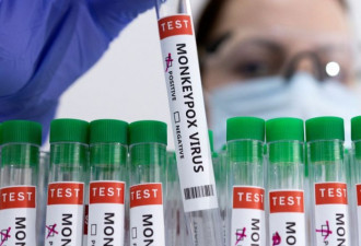 疫苗又来了!魁省确诊15例猴痘 联邦疫苗支援