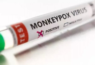 猴痘疫情蔓延 瑞士罗氏药厂研发出快筛试剂