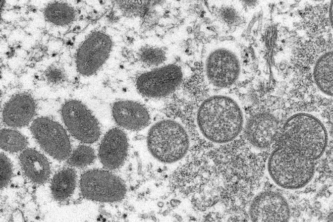 FILE - This 2003 electron microscope image made available by the Centers for Disease Control and Prevention shows mature, oval-shaped monkeypox virions, left, and spherical immature virions, right, obtained from a sample of human skin associated with the 2003 prairie dog outbreak.  (Cynthia S. Goldsmith, Russell Regner/CDC via AP, File).