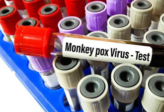 美15州已现45例猴痘病例 白宫再订疫苗