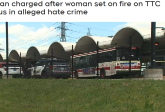 多伦多TTC上随机纵火烧女子的疑犯被控  警方视为仇恨罪案