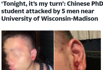 中国博士留学：幸好被打的是我不是别人