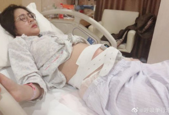 张碧晨早产留下后遗症 多次手术没康复