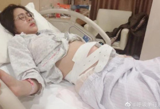 张碧晨故意隐瞒，孩子被扒是在国内生产