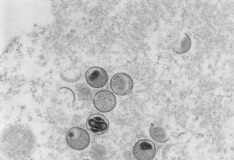 猴痘疫情爆开 研究:病毒突变加快,变多
