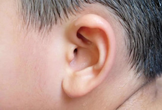 提醒：没事就掏耳朵 小心引起这2大健康隐患