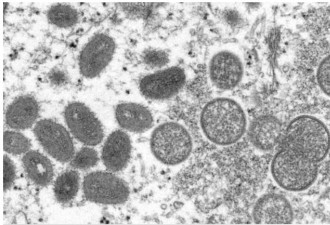 意大利专家结果曝光：猴痘感染媒是它