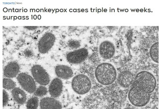 安省猴痘病毒两周狂飙3倍！全球破6000例！这点跟新冠很像！