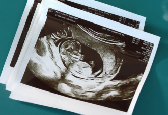 联邦政府指示医院为紧急情形下孕妇堕胎