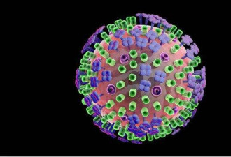 89个国家和地区报告疫情 猴痘会成大流行