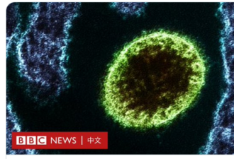 最近在中国发现的“琅琊病毒”是什么?