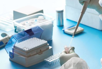 加拿大批准唾液新冠检测法 多伦多一实验室已开始提供此服务