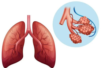 肺部有病 痰液是怎么在人体里先知？