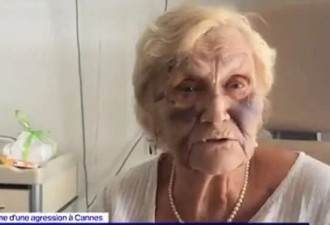 3少年围殴89岁奶奶 家长砸钱逼撤诉