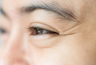 眼角皱纹怎么去除 为你减低肌肤衰老方法