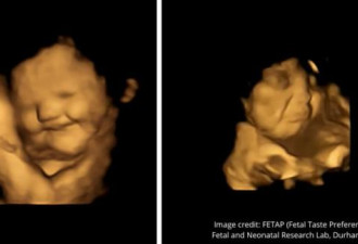 胎儿表情透露对味道喜好 笑脸反应