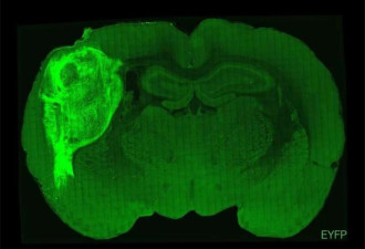 人鼠混合大脑诞生！人脑植入鼠脑后生长