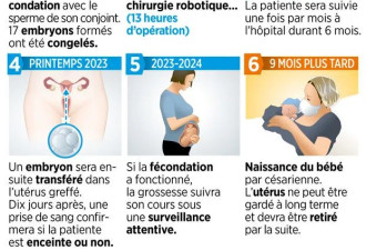 法国逆天科技让没子宫的女人也能生孩子