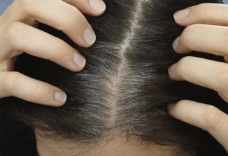 哈佛研究：长白发的人 不易患癌？