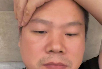 岳云鹏全家确诊阳性，头疼腰疼还频频排气